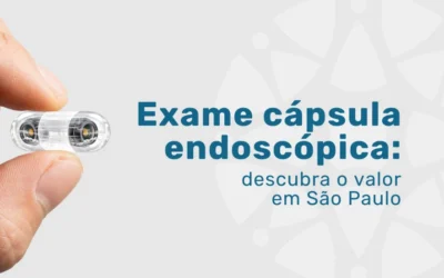 Exame com cápsula endoscópica: R$ 6.000 | Dra. Paula Poletti
