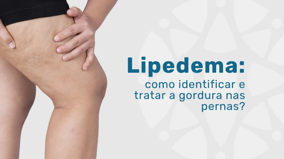 Lipedema: como identificar e tratar a gordura nas pernas?