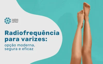Radiofrequência para varizes: opção moderna, segura e eficaz