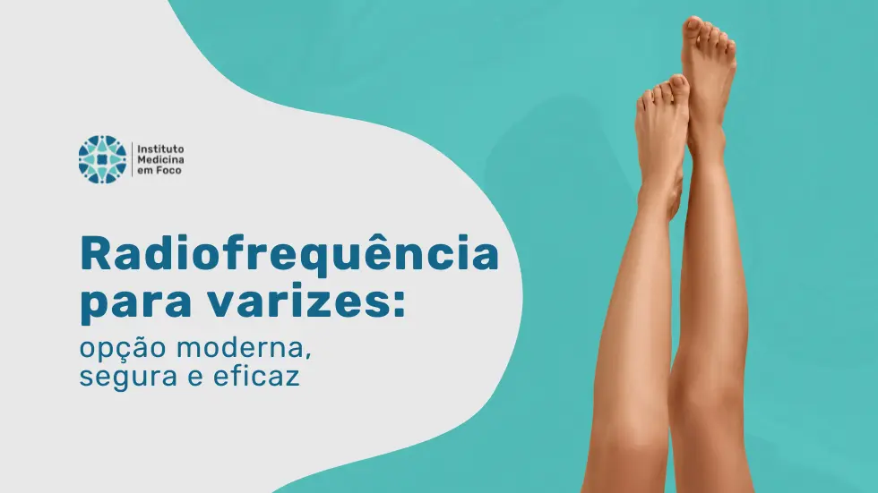 Radiofrequência para varizes: opção moderna, segura e eficaz