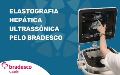 Elastografia Hepática Ultrassônica em SP pelo Bradesco