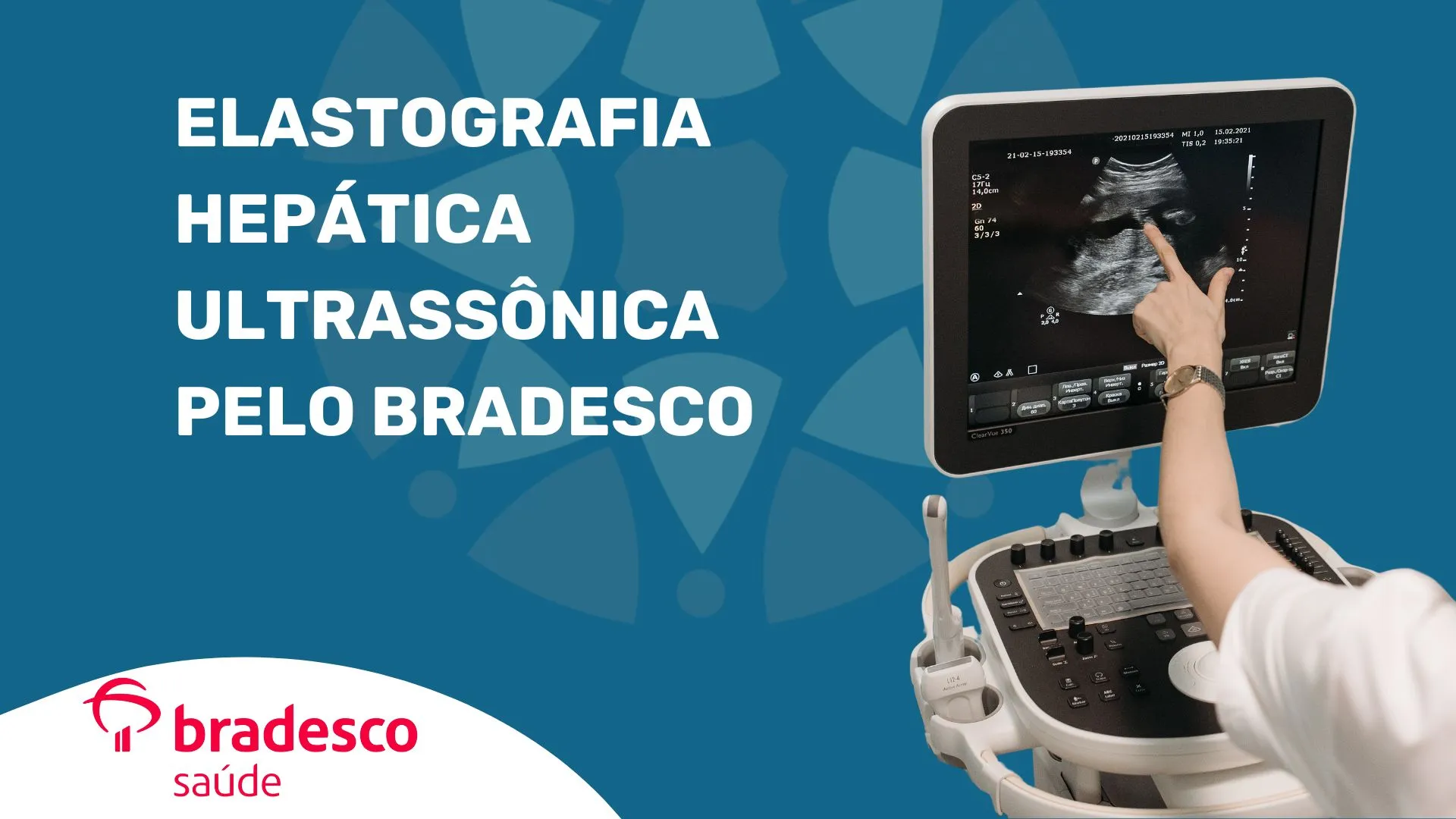 Exame de elastografia hepática ultrassônica com cobertura Bradesco Saúde, sem dor e com laudo rápido em São Paulo – SP
