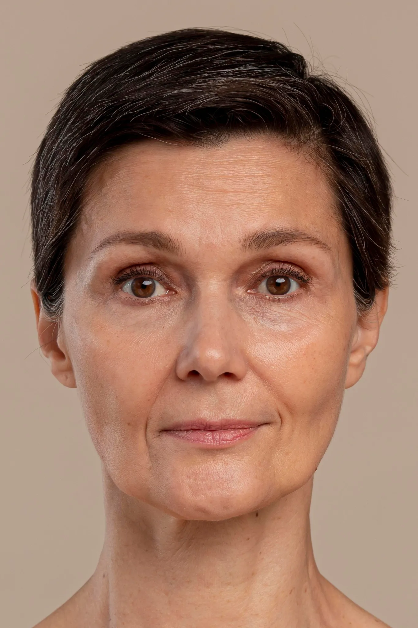 2 Preenchimento Facial ANTES