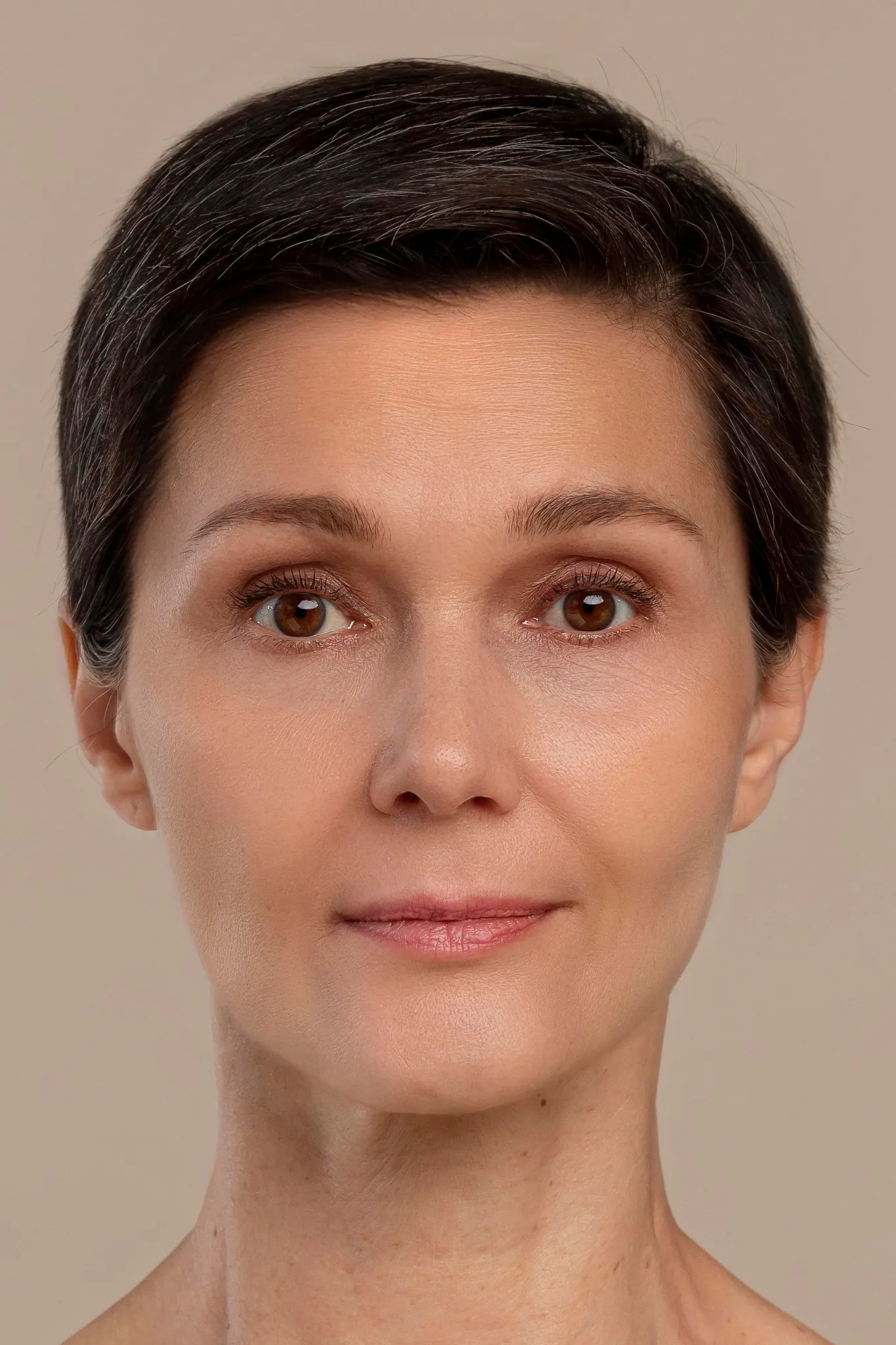 2 Preenchimento Facial DEPOIS