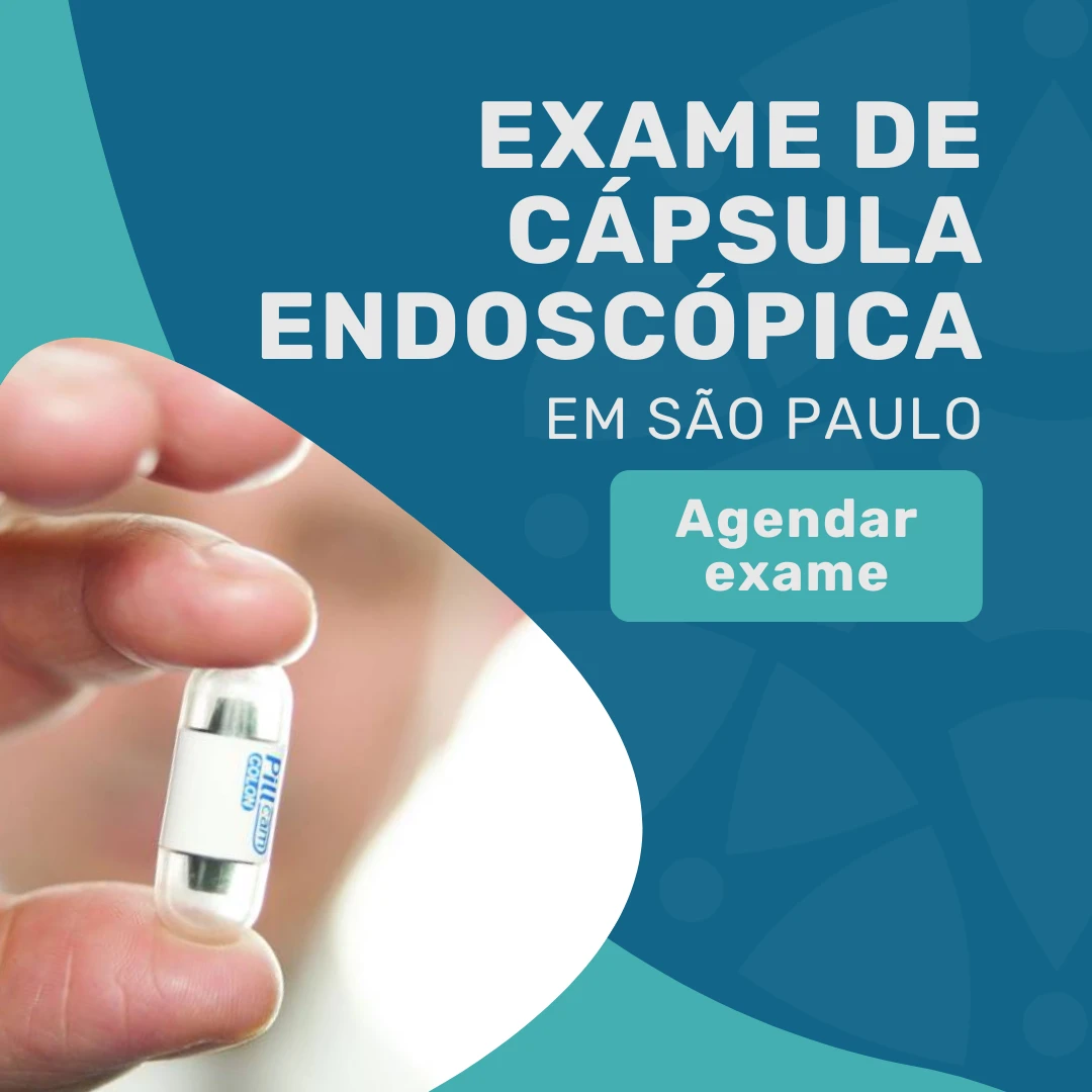 Entre em contato com o Instituto Medicina em foco para agendar exame de cápsula endoscópica em São Paulo com especialistas