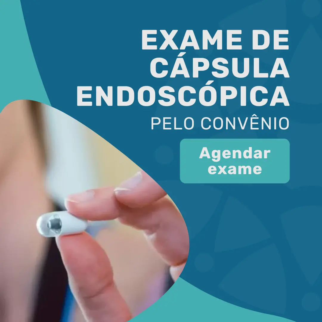 Entre em contato com o Instituto Medicina em foco para agendar exame de cápsula endoscópica pelo convênio em São Paulo