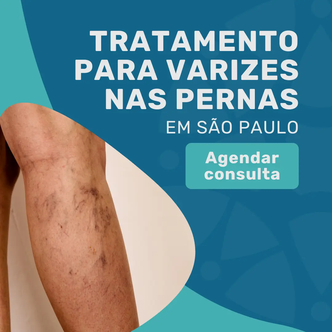 Entre em contato com o Instituto Medicina em foco para agendar sua consulta com angiologista em São Paulo e realizar o seu tratamento para varizes nas pernas