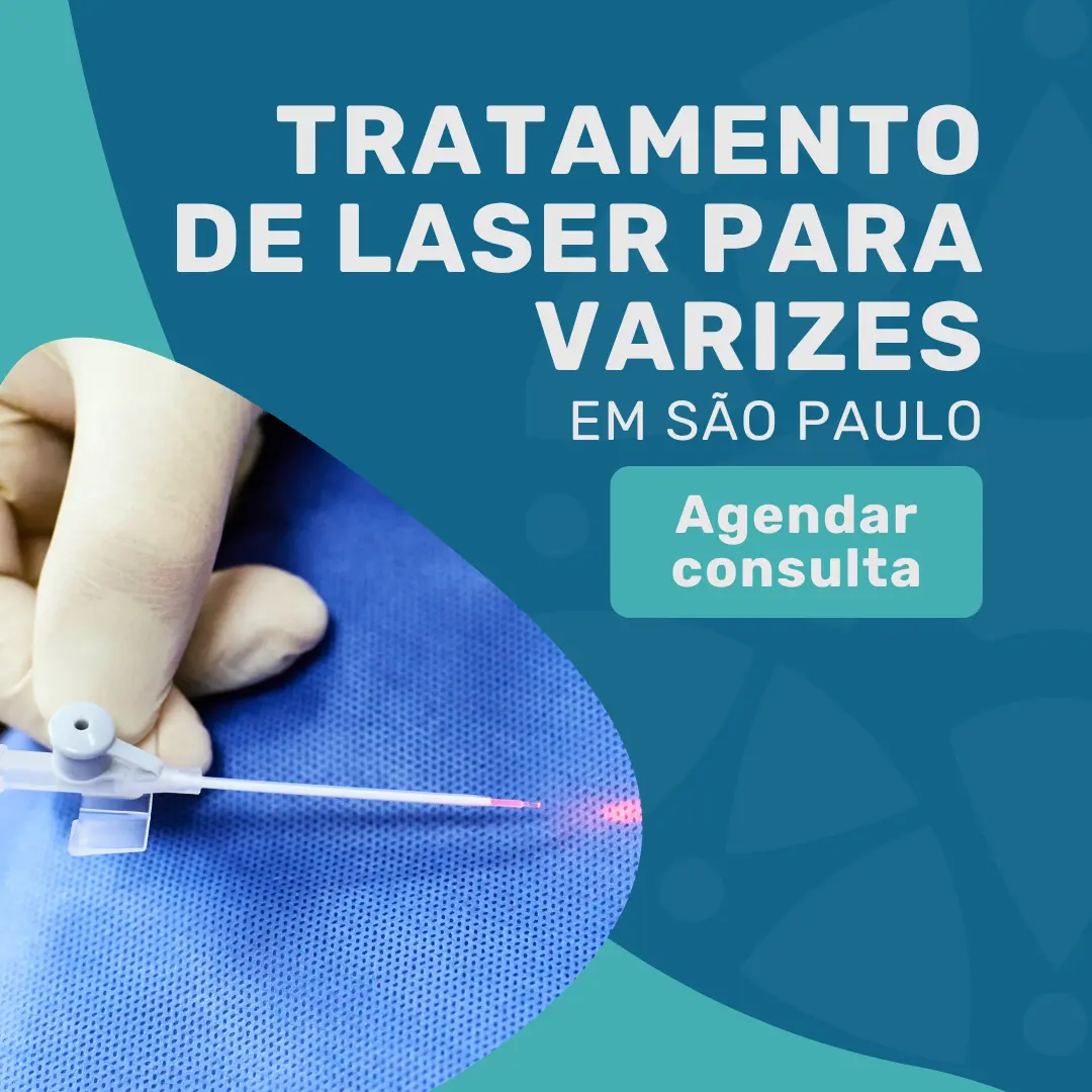Entre em contato com o Instituto Medicina em foco para saber mais sobre Tratamento de laser para varizes em são paulo