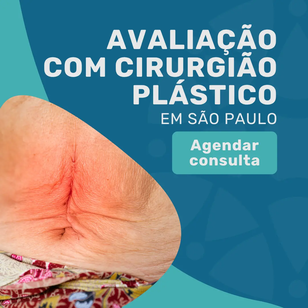 Entre em contato com o Instituto Medicina em foco para uma avaliação com Cirurgião Plástico em são paulo para saber mais sobre a abdominoplastia para a flacidez