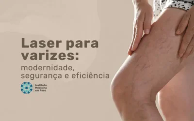 Laser para varizes: modernidade, segurança e eficiência