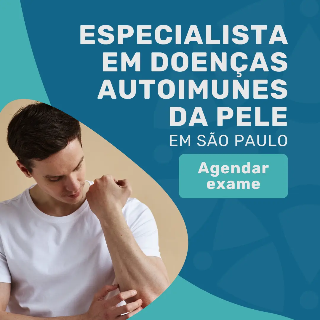 Entre em contato com o Instituto Medicina em foco para agendar consulta com Especialista em doenças autoimunes da pele e saber os seus impactos nas doenças inflamatorias intestinais
