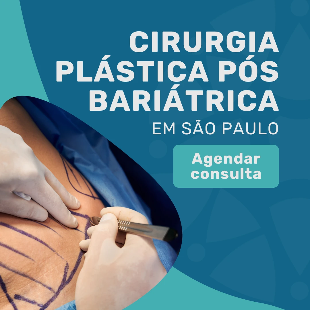 Entre em contato com o Instituto Medicina em foco para agendar consulta com cirurgião plástico em são paulo e saber mais sobre a Cirurgia Plástica pós-bariátrica