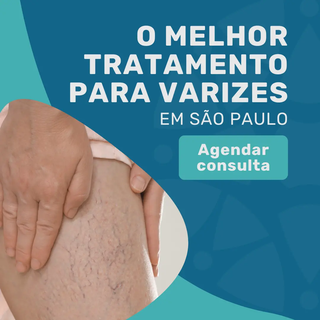 Entre em contato com o Instituto Medicina em foco para agendar consulta com médico angiologista para o Melhor tratamento para varizes em São Paulo