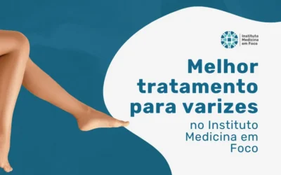 Melhor tratamento para varizes em São Paulo na MEF