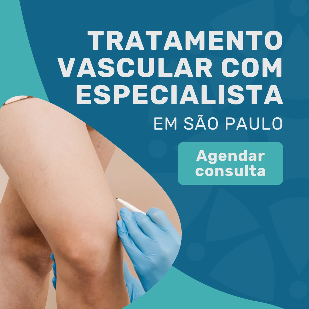 Entre em contato com o Instituto Medicina em foco para agendar consulta com angiologista em são paulo para tratar a sua saúde vascular