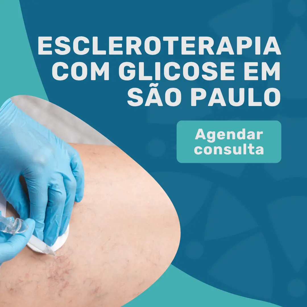 Entre em contato com o Instituto Medicina em foco para agendar consulta com especialista em angiologista em São Paulo para saber mais sobre Escleroterapia com glicose