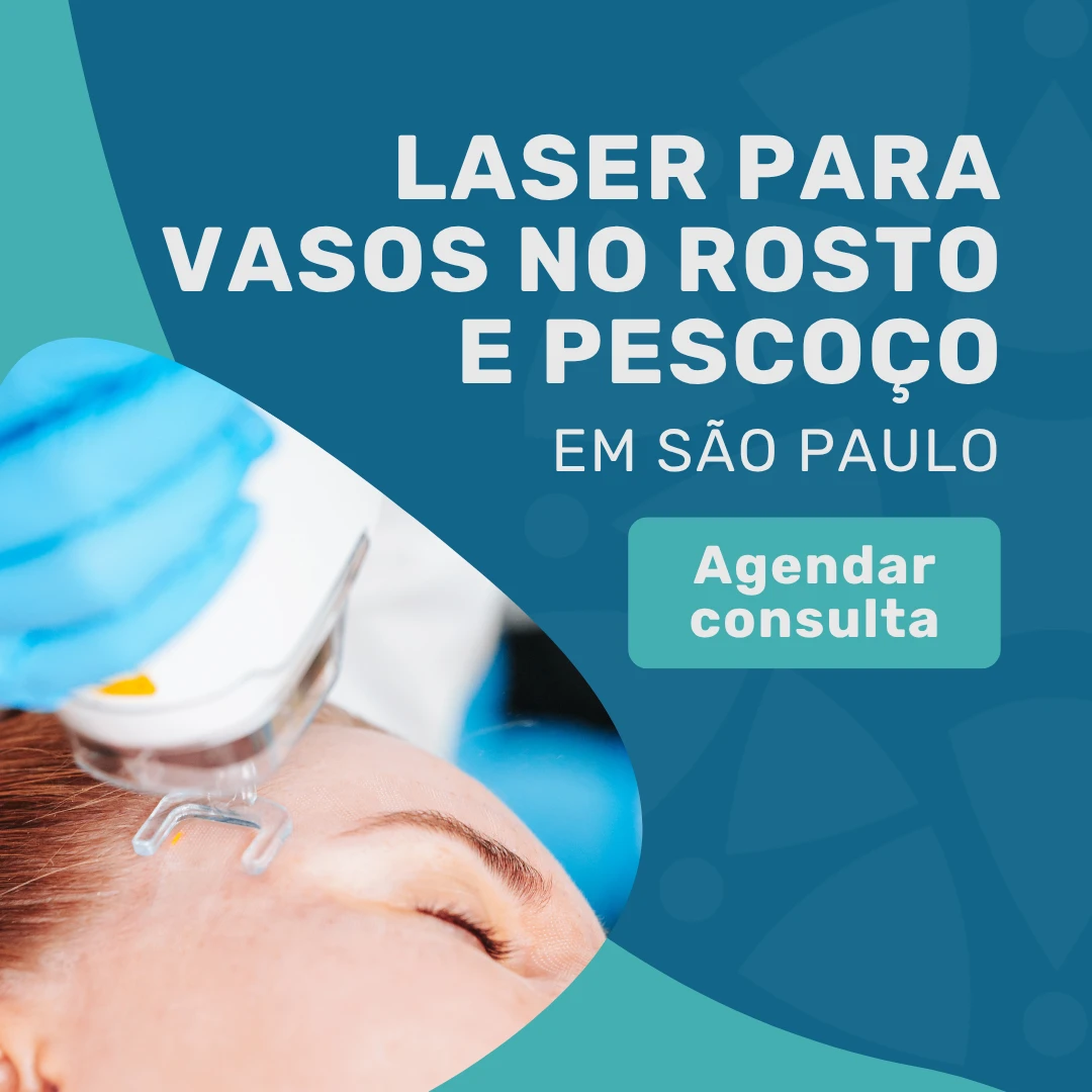 Entre em contato com o Instituto Medicina em foco para agendar uma consulta com Angiologista em São Paulo e fazer tratamento de Laser para vasos no rosto e pescoço