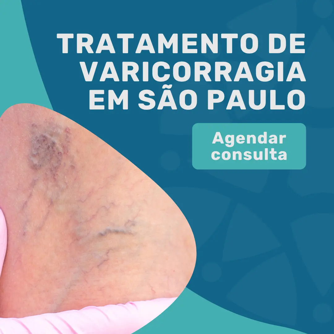 Entre em contato com o Instituto Medicina em foco para agendar uma consulta com angiologista em São Paulo e fazer tratamento para Varicorragia