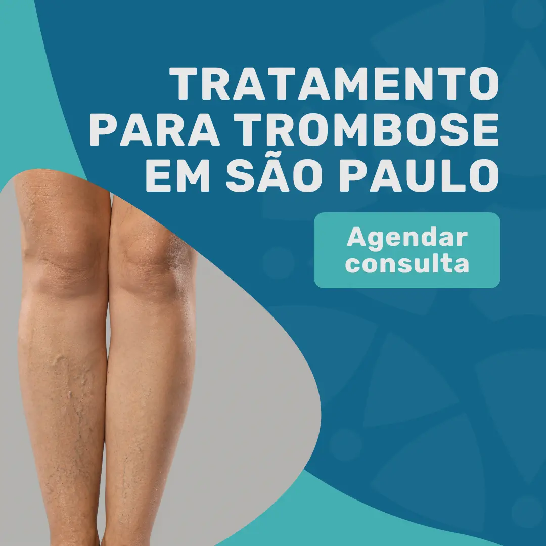 Pernas mostrando trombose e informações