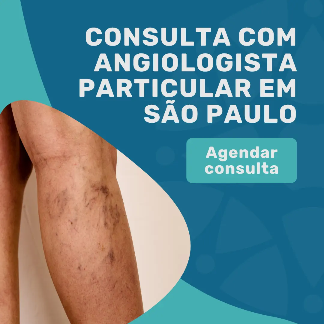 Entre em contato com o Instituto Medicina em foco para saber mais sobre angiologista valor da consulta em são paulo
