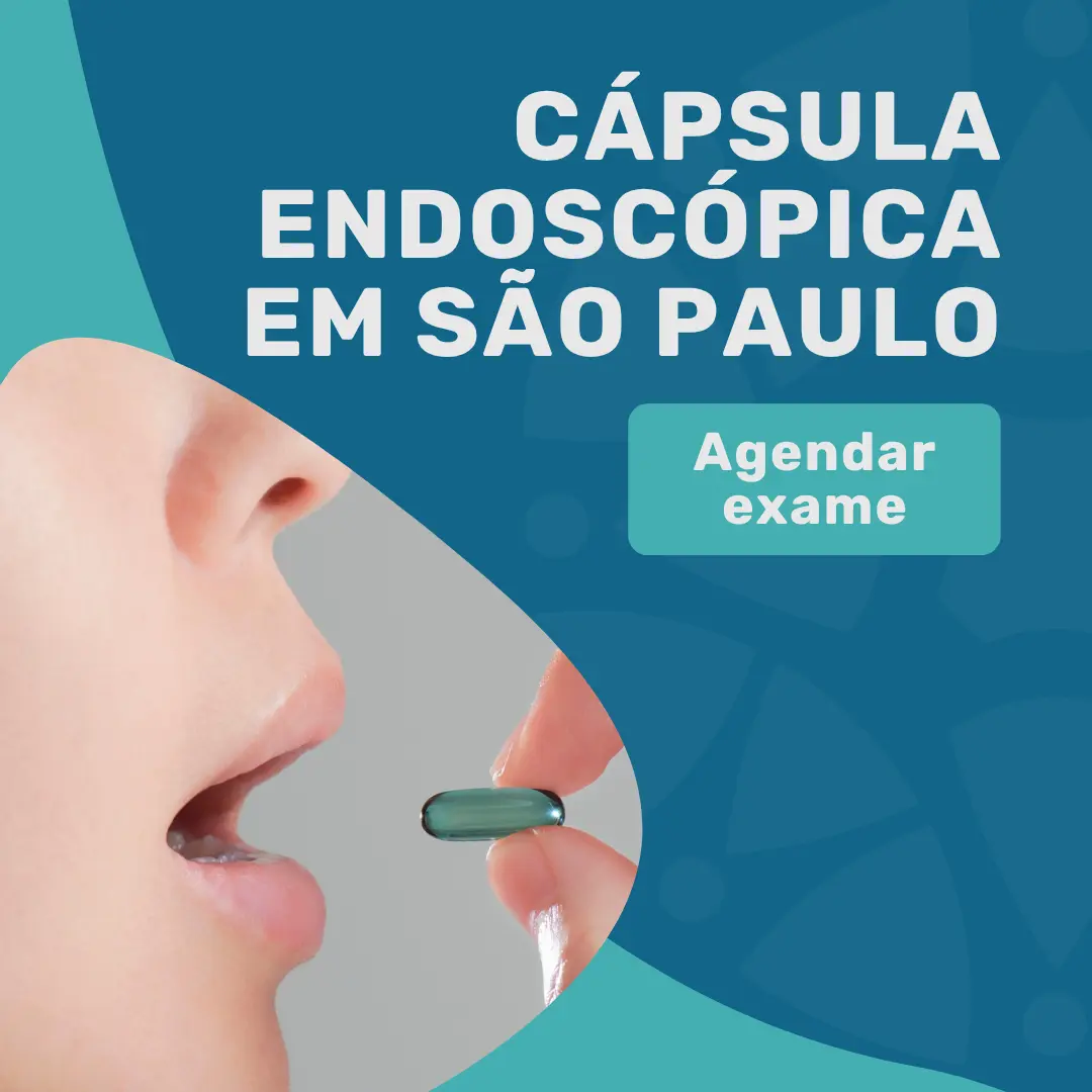 Entre em contato com o Instituto Medicina em foco para saber mais sobre o exame de Capsula endoscopica em sao paulo para diagnostico de doencas inflamatorias intestinais