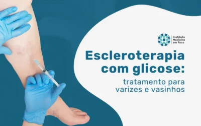Escleroterapia com glicose para varizes e vasinhos