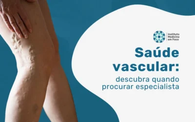 Saúde vascular: quando procurar um especialista?