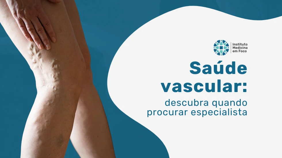 Saúde vascular: quando procurar um especialista?