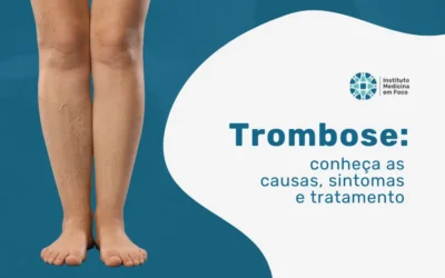 Trombose: sintomas, causas e diagnóstico vascular