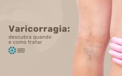 Varicorragia: saiba quando e como tratar