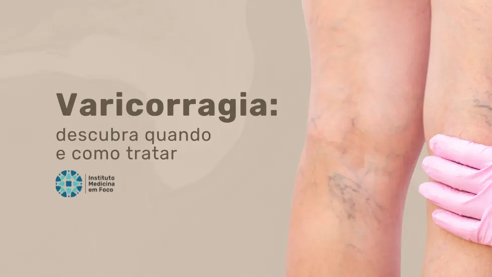 Varicorragia: saiba quando e como tratar