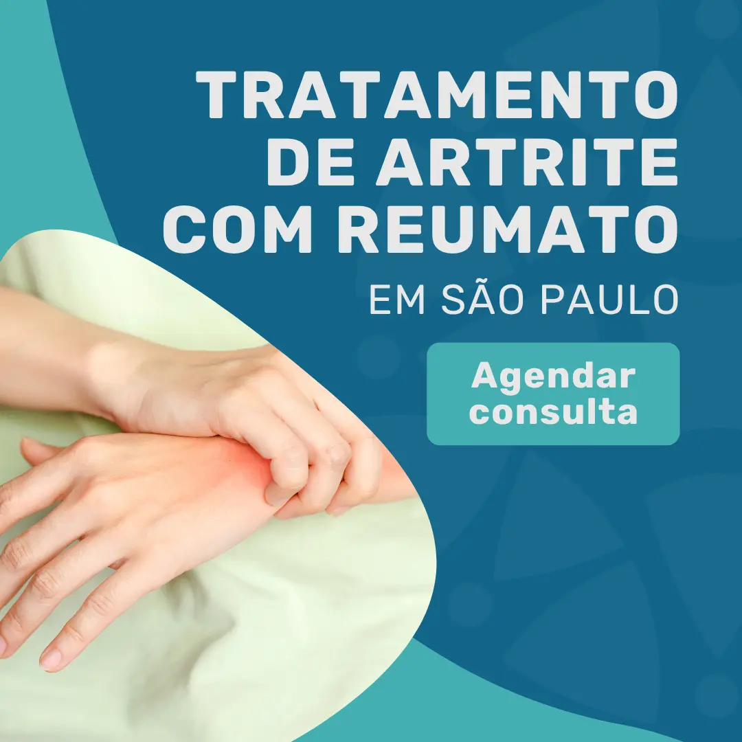 Entre em contato com o Instituto Medicina em foco para consulta com reumatologista para realizar o seu tratamento de artrite com reumato em sao paulo