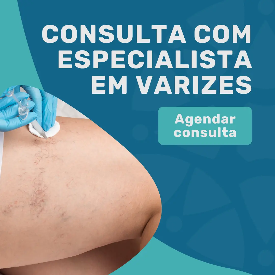Entre em contato com o Instituto Medicina em foco para saber mais sobre consulta com especialista em varizes