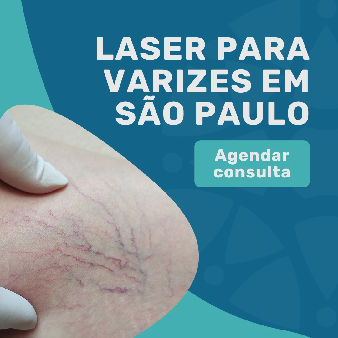 Entre em contato com o Instituto Medicina em foco para saber mais sobre laser para varizes em são paulo