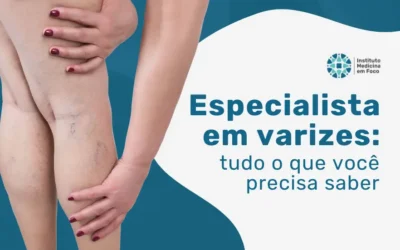 Especialista em varizes: tudo o que você precisa saber
