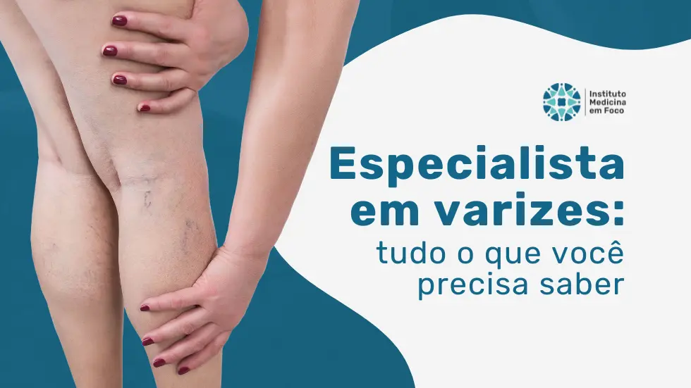 Especialista em varizes: tudo o que você precisa saber