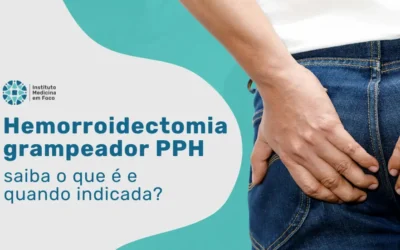 Hemorroidectomia com grampeador PPH quando considerar?