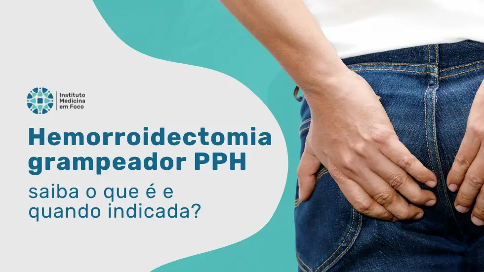 Hemorroidectomia com grampeador PPH quando considerar?
