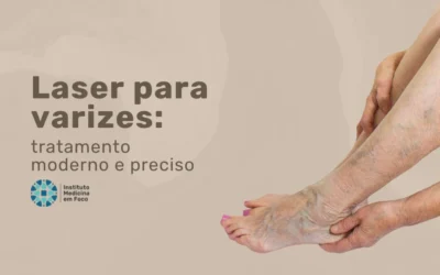 Laser para varizes: tratamento moderno e preciso
