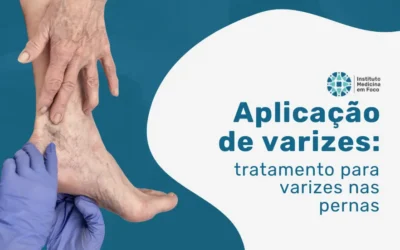 Home 8 Aplicação de varizes: tratamento para varizes nas pernas