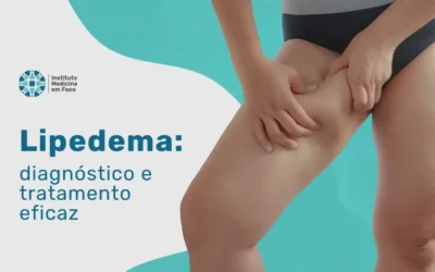 Medicina em Foco 6 Lipedema: diagnóstico e tratamento experiente