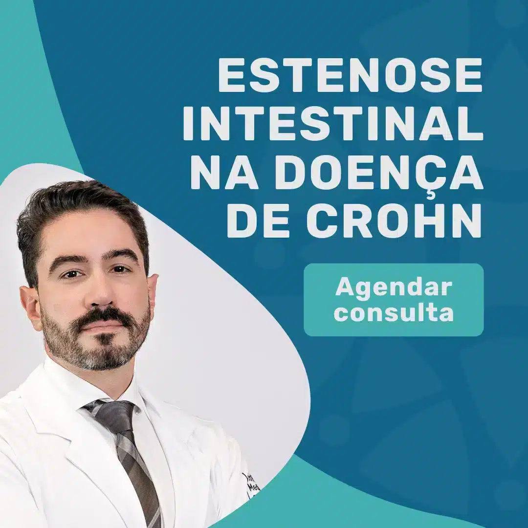 Entre em contato para agendar uma consulta com Dr. Rodrigo Barbosa, Coloproctologista em São Paulo, para saber mais sobre estenose intestinal na doença de crohn
