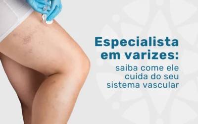 Home 7 Como o especialista em varizes cuida do seu sistema vascular