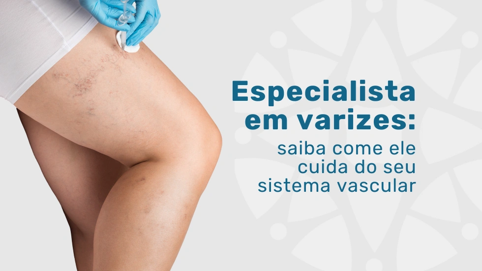 Como o especialista em varizes cuida do seu sistema vascular