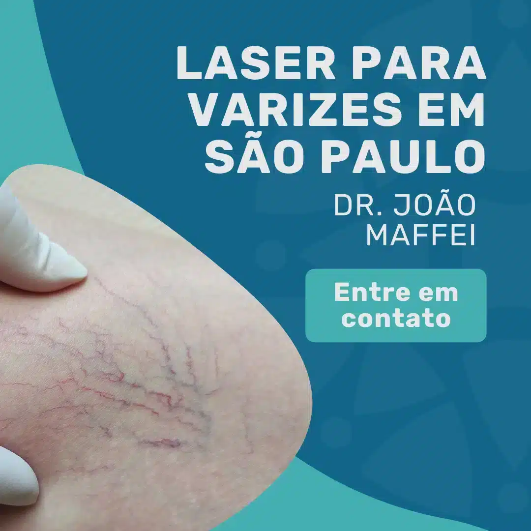 Laser para varizes: tratamento para varizes e vasinhos 2 Entre em contato para agendar sua consulta com Angiologista em São Paulo, Dr. João Maffei, para realizar seu tratamento de lases para varizes em são paulo