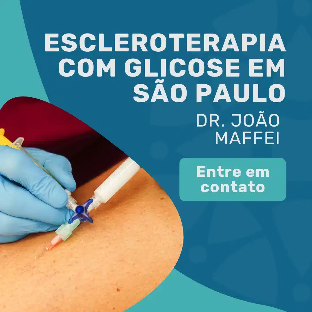 Escleroterapia com glicose para varizes e vasinhos 2 Entre em contato para agendar sua consulta com Angiologista em São Paulo, Dr. João Maffei, para realizar sua escleroterapia com glicose em são paulo