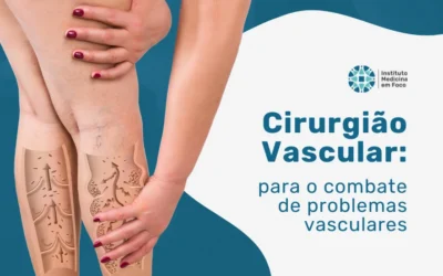 Home 8 Cirurgião Vascular: guia para combater problemas vasculares