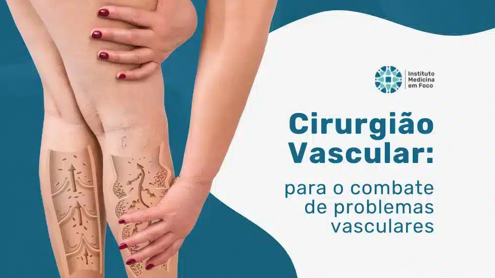 Arquivo medicina em foco 33 MEF - Cirurgião Vascular guia para combater problemas vasculares