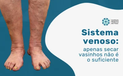 Home 7 Entenda melhor a importância de cuidar do sistema venoso