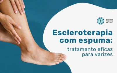 Home 7 Escleroterapia com espuma: tratamento eficaz para varizes